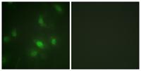 Stat5a/b (phospho Ser726/731) Polyclonal Antibody