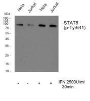 Stat6 (phospho Tyr641) Polyclonal Antibody