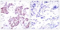 Stat6 (phospho Tyr641) Polyclonal Antibody