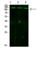 JAK2/3 (Phospho Tyr966/939) Antibody