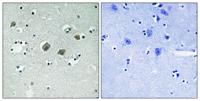 JAK2 (phospho Tyr570) Polyclonal Antibody