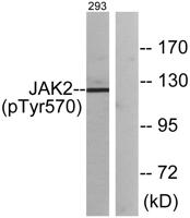 JAK2 (phospho Tyr570) Polyclonal Antibody