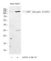 JAK2 (phospho Tyr931) Polyclonal Antibody