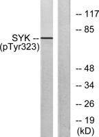 Syk (phospho Tyr323) Polyclonal Antibody