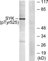 Syk (phospho Tyr525) Polyclonal Antibody