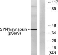 Synapsin I (phospho Ser9) Polyclonal Antibody