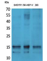 Synuclein-α (phospho Tyr125) Polyclonal Antibody