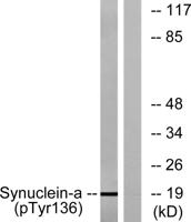 Synuclein-α (phospho Tyr136) Polyclonal Antibody