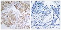 IGF-IR (phospho Tyr1161) Polyclonal Antibody