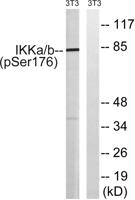 IKKα/β (phospho Ser176/177) Polyclonal Antibody