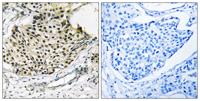 IKKγ (phospho Ser31) Polyclonal Antibody