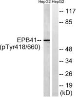 4.1R (phospho Tyr660) Polyclonal Antibody