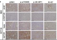 4E-BP1 (phospho Ser65) Polyclonal Antibody