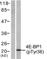 4E-BP1 (phospho Thr37) Polyclonal Antibody