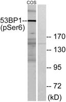 53BP1 (phospho Ser6) Polyclonal Antibody