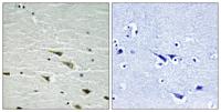 Trk A (phospho Tyr757) Polyclonal Antibody