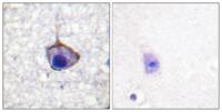 Trk A (phospho Tyr791) Polyclonal Antibody