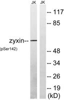 Zyxin (phospho Ser142) Polyclonal Antibody