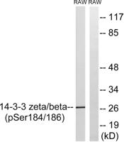 14-3-3 β/ζ (phospho Ser184/186) Polyclonal Antibody