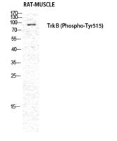 Trk B (phospho Tyr516) Polyclonal Antibody