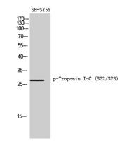 Troponin I-C (phospho Ser22/S23) Polyclonal Antibody