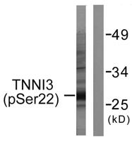 Troponin I-C (phospho Ser22/S23) Polyclonal Antibody