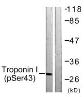 Troponin I-C (phospho Ser43) Polyclonal Antibody