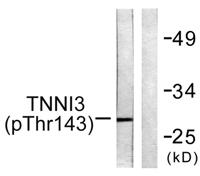 Troponin I-C (phospho Thr142) Polyclonal Antibody