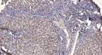 Troponin I-C (phospho Thr142) Polyclonal Antibody