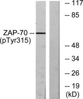 ZAP-70 (phospho Tyr315) Polyclonal Antibody