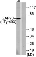 ZAP-70 (phospho Tyr493) Polyclonal Antibody