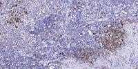 VHL (phospho Ser68) Polyclonal Antibody