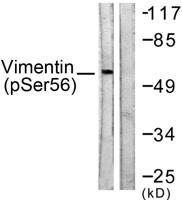 Vimentin (phospho Ser56) Polyclonal Antibody