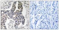 Vimentin (phospho Ser83) Polyclonal Antibody