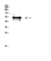 Vimentin (Phospho Tyr38) Polyclonal Antibody