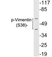 Vimentin (Phospho Tyr38) Polyclonal Antibody