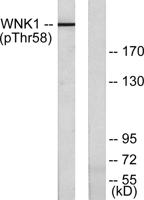 WNK1 (phospho Thr60) Polyclonal Antibody