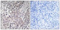 VASP (phospho Ser157) Polyclonal Antibody