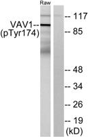 Vav1 (phospho Tyr174) Polyclonal Antibody