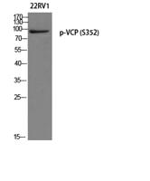 VCP (phospho Ser352) Polyclonal Antibody