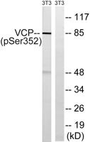 VCP (phospho Ser352) Polyclonal Antibody