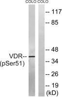 VDR (phospho Ser51) Polyclonal Antibody