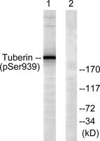 Tuberin (phospho Ser939) Polyclonal Antibody