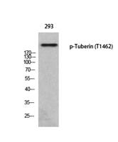 Tuberin (phospho Thr1462) Polyclonal Antibody