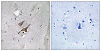 Tuberin (phospho Tyr1571) Polyclonal Antibody