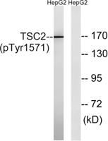 Tuberin (phospho Tyr1571) Polyclonal Antibody