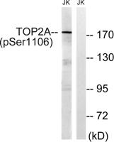 Topo IIα (phospho Ser1106) Polyclonal Antibody