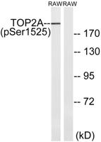 Topo IIα (phospho Ser1525) Polyclonal Antibody