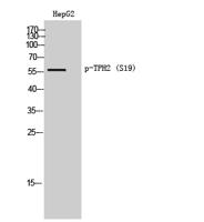 TPH2 (phospho Ser19) Polyclonal Antibody