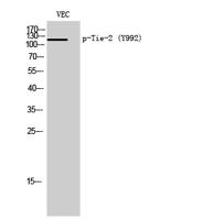 Tie-2 (phospho Tyr992) Polyclonal Antibody